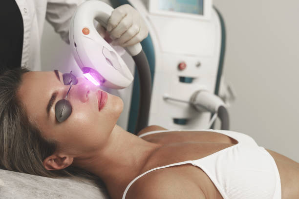 Behandling av ytliga blodkärl och rosacea på hudklinik i Järfälla Barkarbystaden